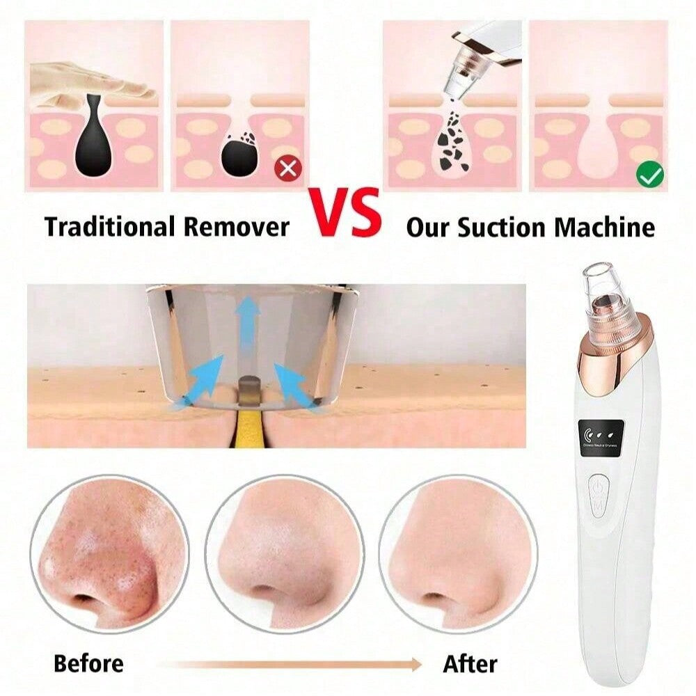 MODENIX™– Electric Acne Pore Cleaner & Blackhead Remover