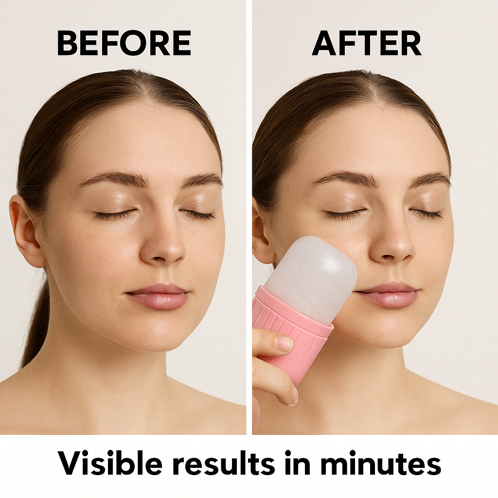 MODENIX™-Ice Face Roller